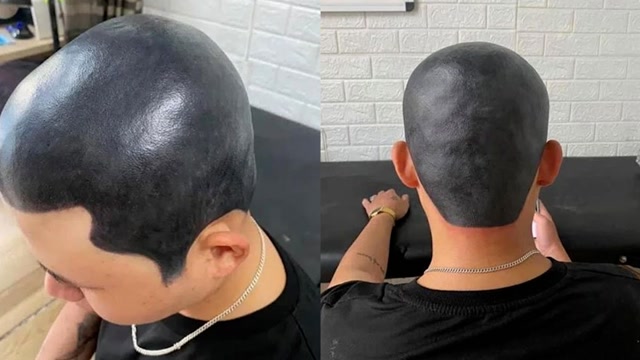 越南男子想剃光头不敢违抗妻子,偷偷剃光后给头皮纹成全黑