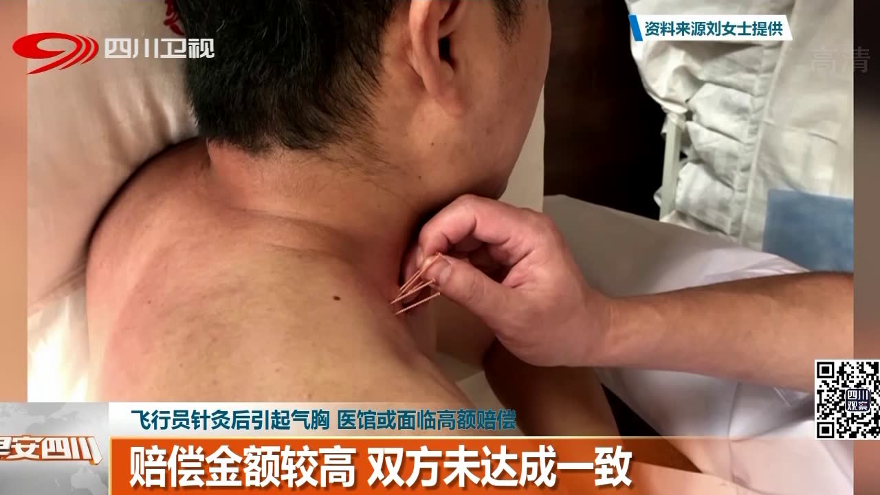 飞行员针灸后引起气胸 医馆或面临高额赔偿