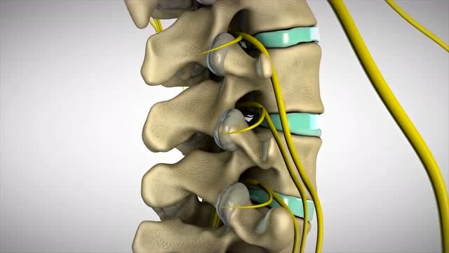 腰椎间盘突出3d演示治疗过程,腰椎突出者好好看看吧!有好处的