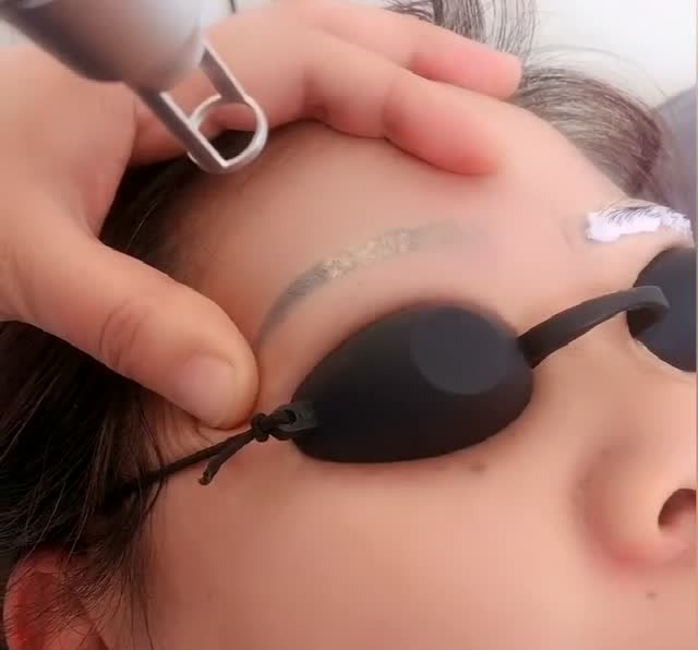 激光清洗眉毛太可怕了,眼睛捂着,光听声音都感觉慎得慌!