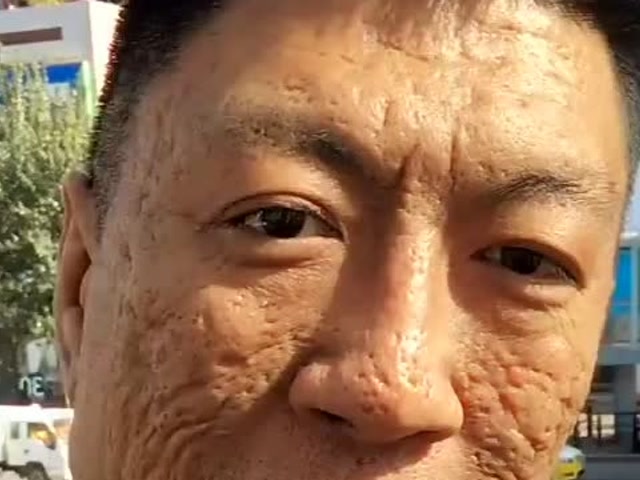 你能找出来比我脸上麻子还多人的,算我认输.因为我叫张麻子