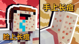 我的世界：残酷二选一！你希望脸上长痘还是手上长痘？答案厉害了