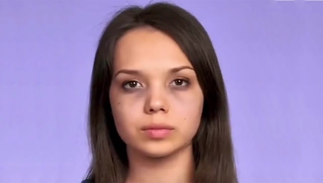 女生黑眼圈不用担心,记住美女这招,几分钟就能消除