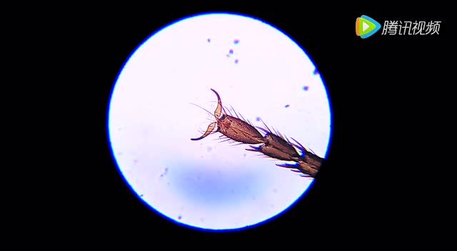 显微镜下的苍蝇图片