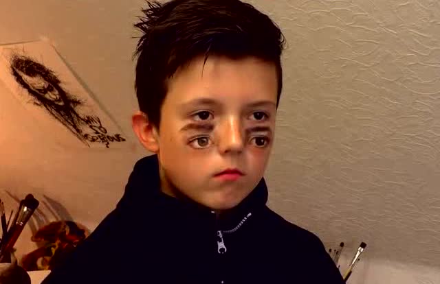 头晕,四只眼睛是怎么来的