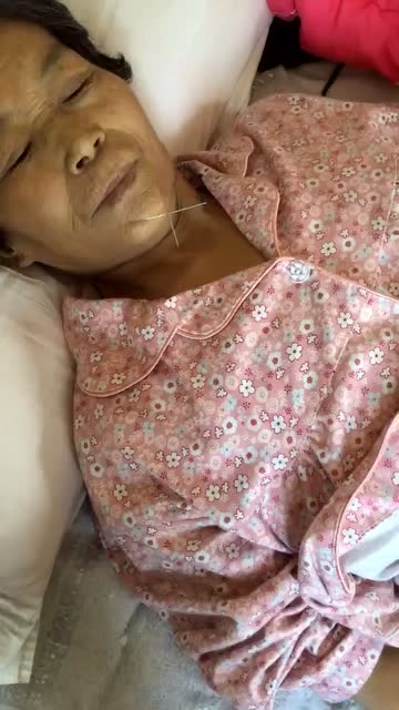 张伟康老师针灸肝癌晚期患者