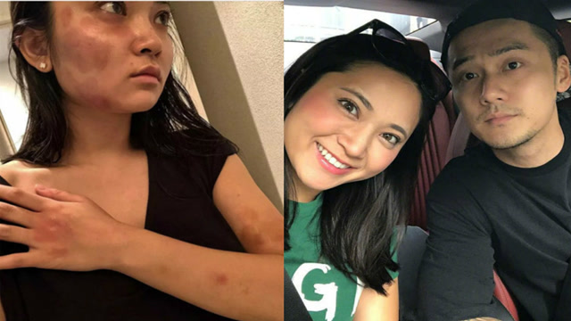 蒋劲夫女友曝出受伤照片,蒋劲夫回应家暴:为自己的行为感到羞愧