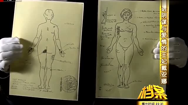 戴安娜王妃一份令人难过的尸检报告死因让人感觉无比痛心