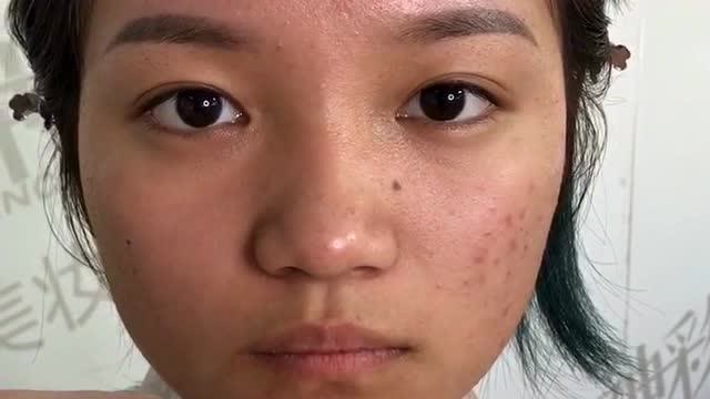 美女无美颜无滤镜下的真实状态,痘痘肌真实化妆,化完妆才叫美!