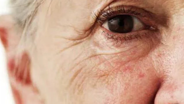 上了年纪脸上长皱纹不要担心,教你一招,满脸胶原蛋白弹性十足!