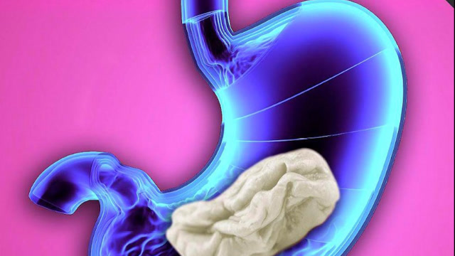 口香糖黏糊糊的,那么不小心把它吞进肚子里,会不会消化呢?