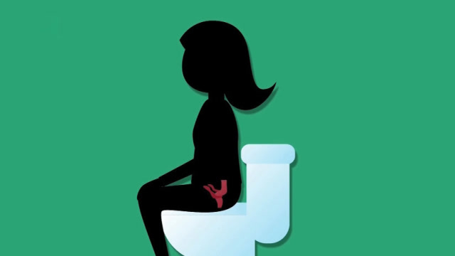 坐马桶的正确姿势是什么