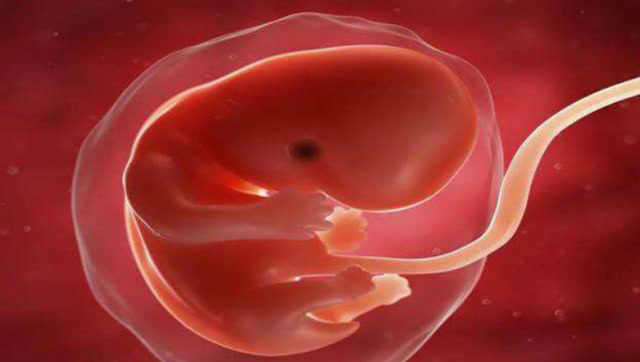 八十天胎儿图片图片