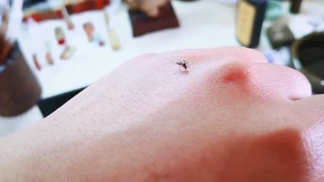 蚊子飞到我的手背上吸血,我用皮肤的褶皱把它夹住了,网友:狠人!