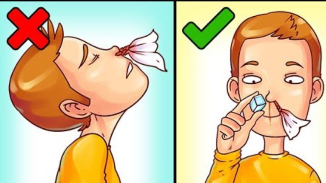 止鼻血方法图片