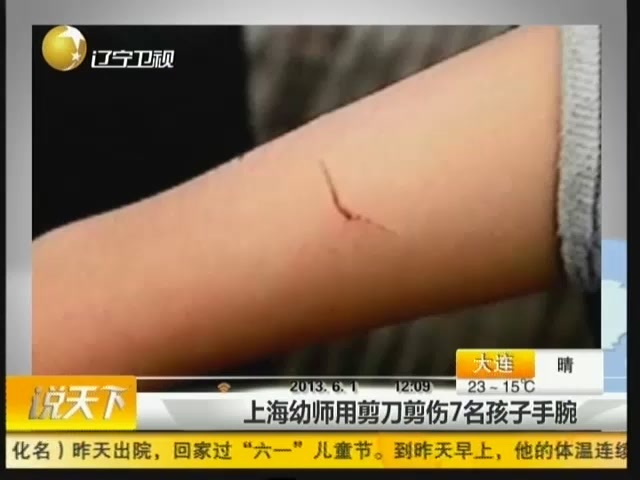 上海一幼师用剪刀剪伤7名孩子手腕