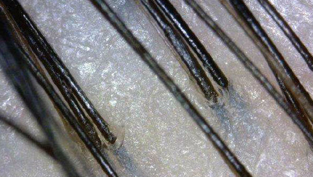 两天没洗的头发和刚洗的头发有什么区别?显微镜下的真相令人吃惊