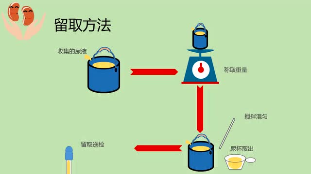 24小时尿标本留取方法