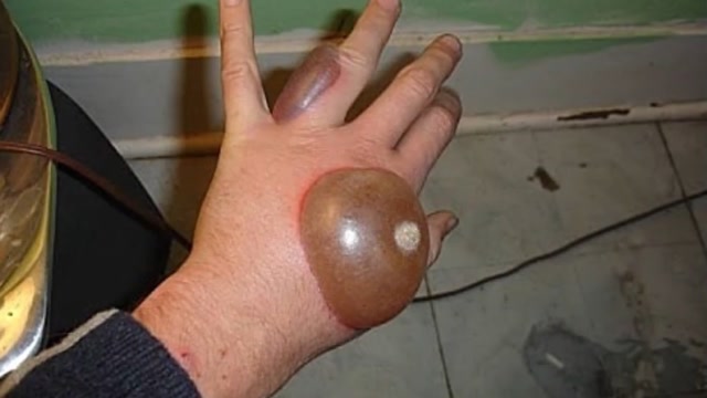 把手放到-196℃的液氮中,手会被冻伤吗?专家:千万别没事找事!