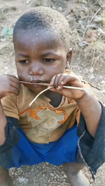 非洲贫困儿童 饥饿图片