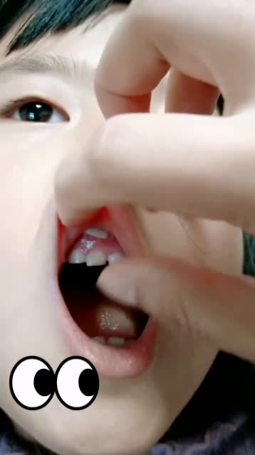 这地方长牙齿也太怪了!请问能拔掉吗?