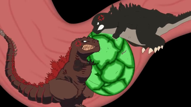 哥斯拉肚子疼检查发现是蛋卡在肚子里可是怎么取出来呢