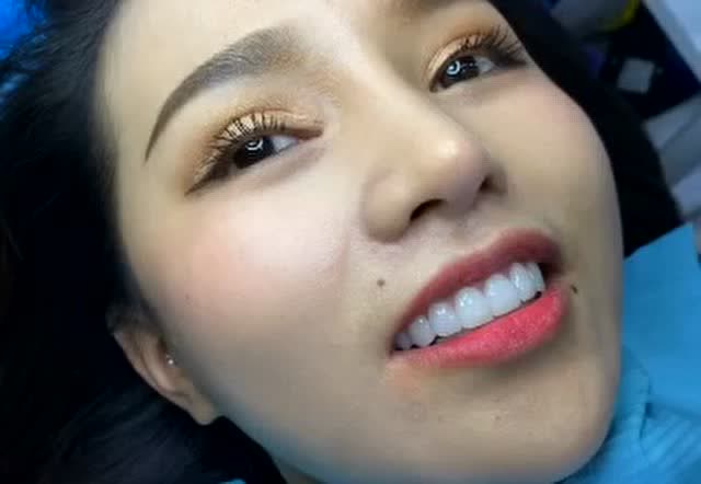 小姐姐满口晶莹剔透的牙齿,亮白亮白的不是刷出的吧?