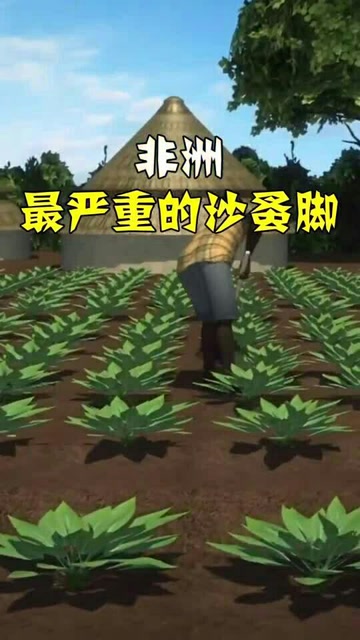 非洲最严重的沙蚤脚