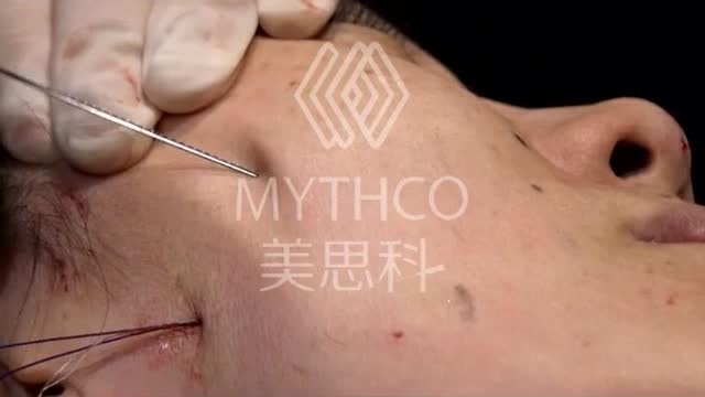 美思科 线雕教学 线雕培训 蛋白线埋线 微整