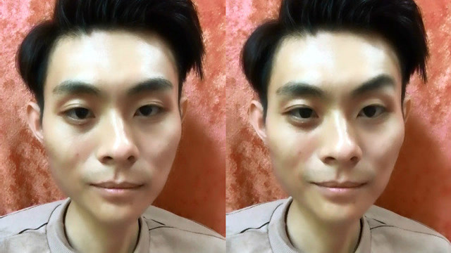 男子直播时突现面部扭曲表情僵硬,眼神涣散行为异常