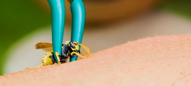 近距离看蜜蜂蛰人的全过程隔着屏幕都感觉疼