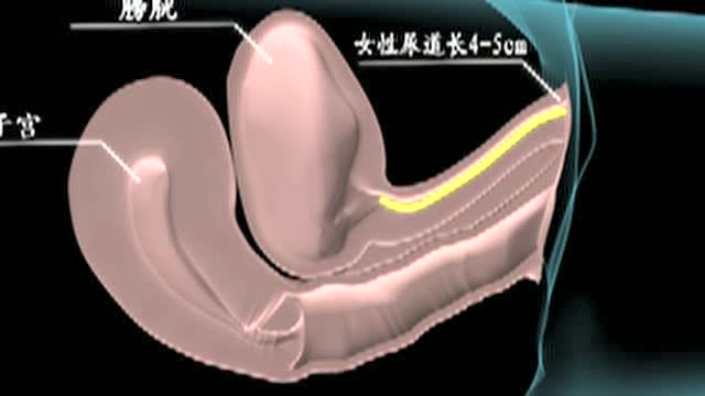 女性留置导尿管术动画