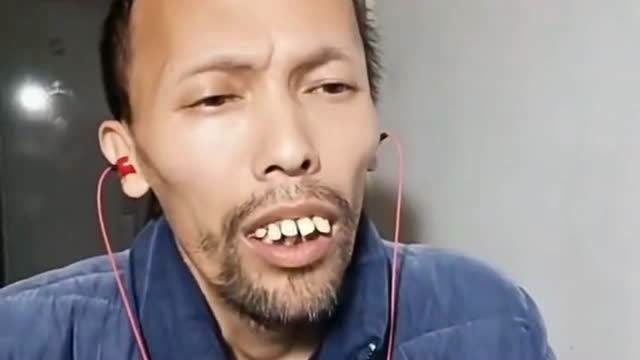 大爷的牙齿是要分离吗,唱歌把牙齿都给唱突出了,这是我见过最奇葩的人