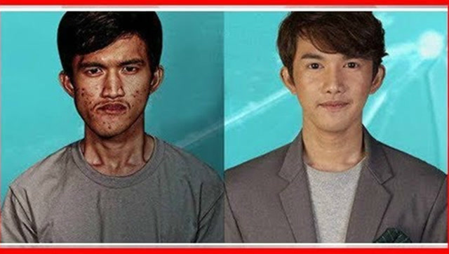 泰国丑男整容变身小鲜肉,连自己妈妈都认不出来