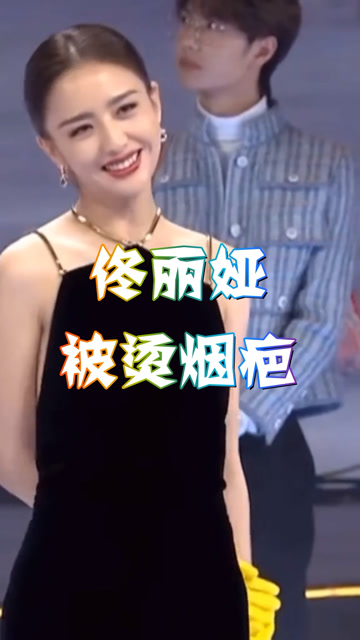 佟丽娅被烫烟疤陈思诚却说有意思网友心疼丫丫