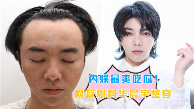 内娱最爽吃瓜!网友爆料华晨宇整容并出轨张碧晨,一锤又一锤