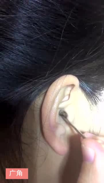 耳科赵医生掏耳朵竟然给媳妇掏出了硬菜