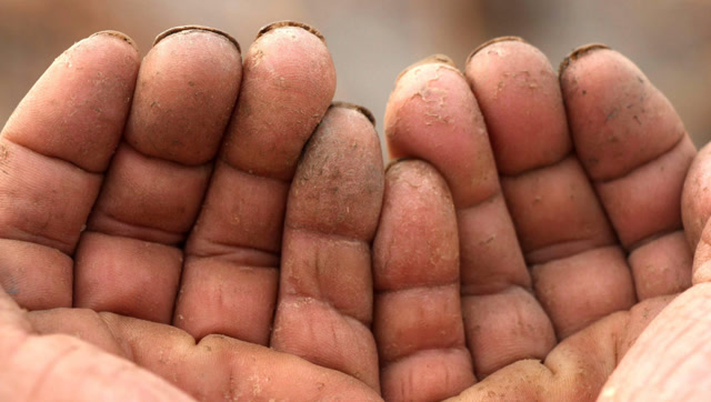 40岁大妈的手粗糙难看,用了这招,像婴儿般白嫩好看