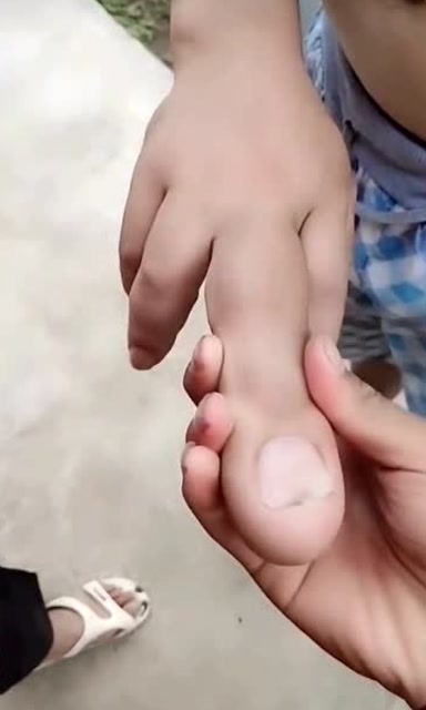 这大哥真是天赋异禀,中指这么粗,怎么练的?