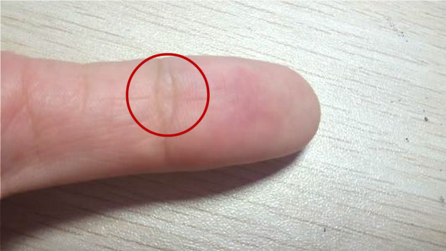 女人左手"夫子眼"右手没有,同样家境富裕,享不尽的荣华富贵!