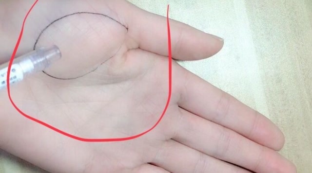 金星丘饱满的人,都有让人羡慕的财运,你的手相是这样的吗