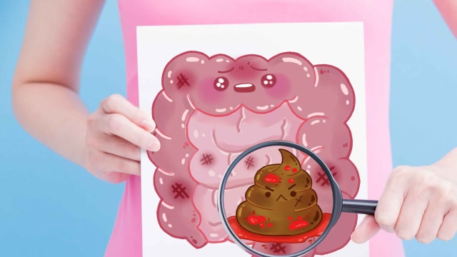 长期大便不成形?别总盯着湿气,要当心肠癌来敲门!