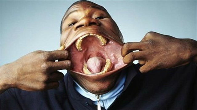 世界第一大嘴男,长17厘米,大得吓人