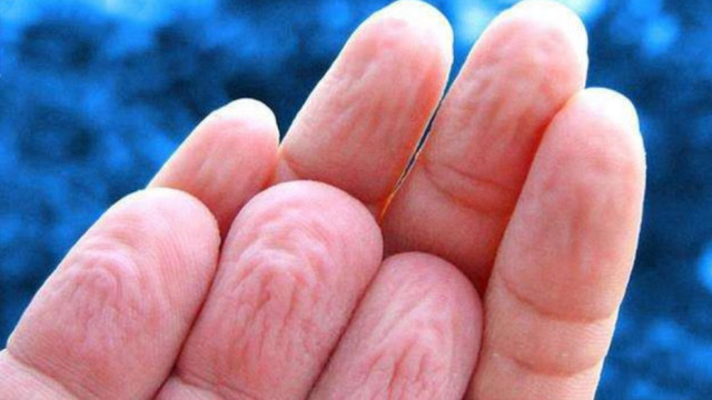 手指长时间浸泡在水里,为什么会变得坑坑洼洼?看完我都着急了!