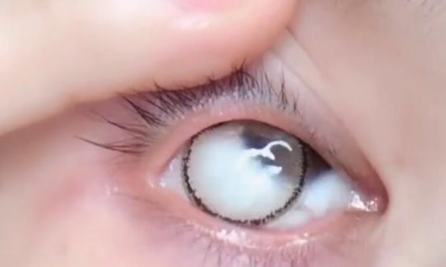 眼睛太小的你戴美瞳是不是也这样,终于戴进去竟这样了!