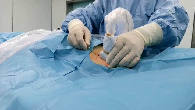 乳腺结节激光消融术