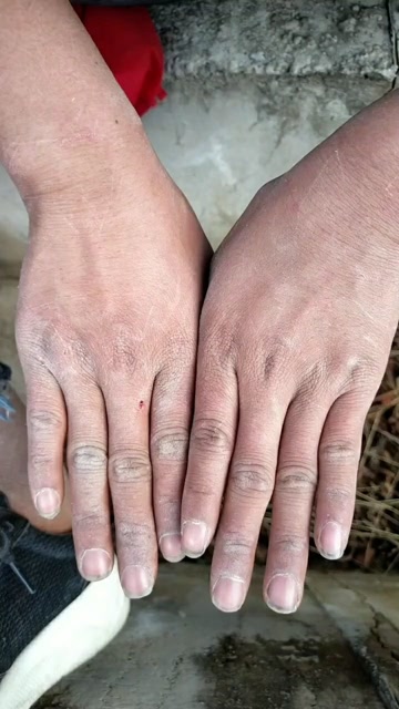 妈妈说我的手太粗糙了,一点也不像小女孩的手