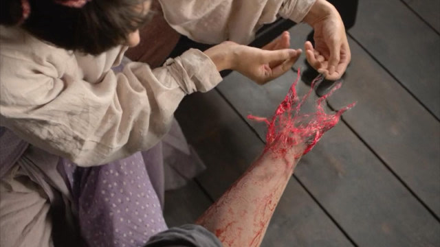 小圆圈超能力太牛,竟能让断臂重生,这开医馆得多挣钱