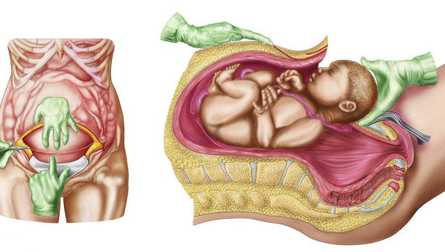 剖二胎比剖一胎疼得多!剖二胎的妈妈可要做好心理准备!
