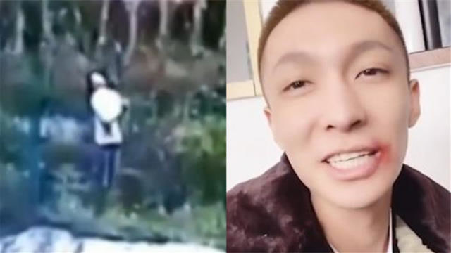 下一个 打开循环播放 100